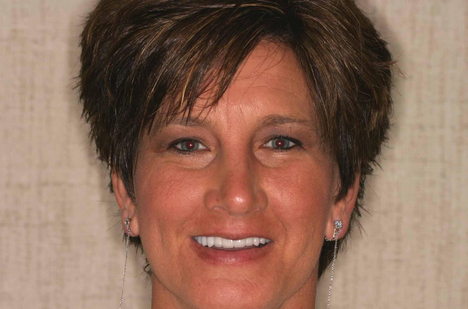 Cosmetic Dentist Fort Myers Cape Coral Naples FL